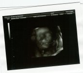 baby @ 22.5 weeks.jpg