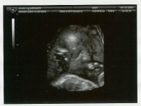 baby@27.5 weeks.jpg