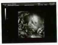 baby@31.5 weeks.jpg