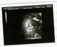 baby@34.5 weeks 001.jpg